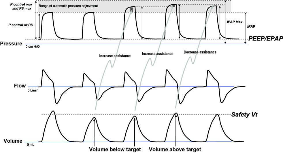 SafetyVolume_graph